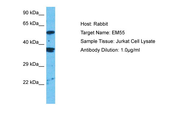 Host: Rabbit Target Name: EM55 Sample Type: Jurkat Whole Cell lysates Antibody Dilution: 1.0ug/ml