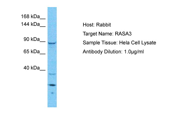 Host: Rabbit Target Name: RASA3 Sample Type: Hela Whole Cell lysates Antibody Dilution: 1ug/ml