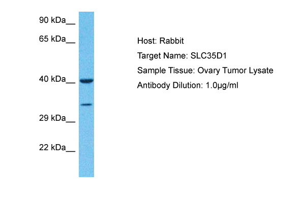Host: Rabbit Target Name: S35D1 Sample Type: Ovary Tumor lysates Antibody Dilution: 1.0ug/ml