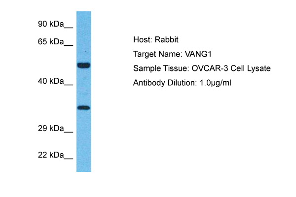 Host: Rabbit Target Name: VANG1 Sample Type: OVCAR-3 Whole Cell lysates Antibody Dilution: 1.0ug/ml
