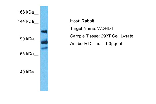 Rat brain lysate was resolved by electrophoresis, transferred to PVDF and probed with anti-Prion Protein, clone 2G11 (1 ug/mL). Proteins were visualized using a goat anti-mouse secondary antibody conj ugated to HRP and a chemiluminescence detection system. Arrow indicates Prion Protein (~27 kDa)