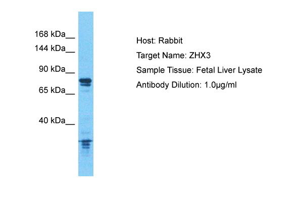Host: Rabbit Target Name: ZHX3 Sample Type: Fetal Liver Antibody Dilution: 1.0ug/ml