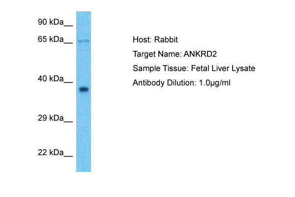 Host: Rabbit Target Name: ANKRD2 Sample Type: Fetal Liver lysates Antibody Dilution: 1.0ug/ml
