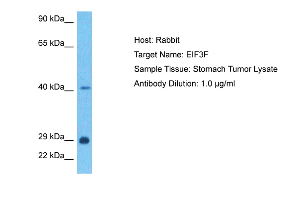 Staining of paraffin embedded human tonsil with mouse anti human CD79a antibody.