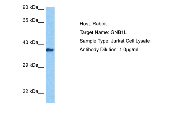 Host: Rabbit Target Name: GNB1L Sample Tissue: Jurkat Whole Cell lysates Antibody Dilution: 1ug/ml