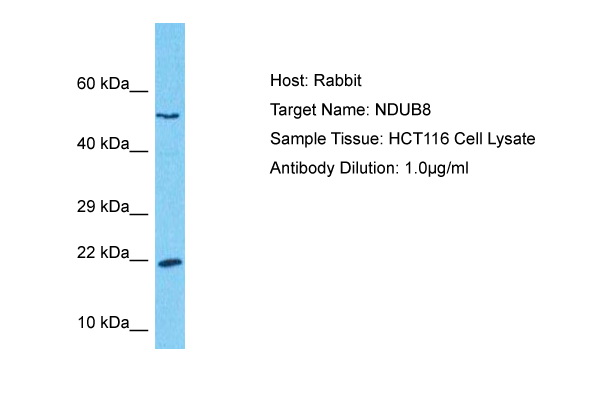 Host: Rabbit Target Name: NDUB8 Sample Type: HCT116 Whole Cell lysates Antibody Dilution: 1.0ug/ml