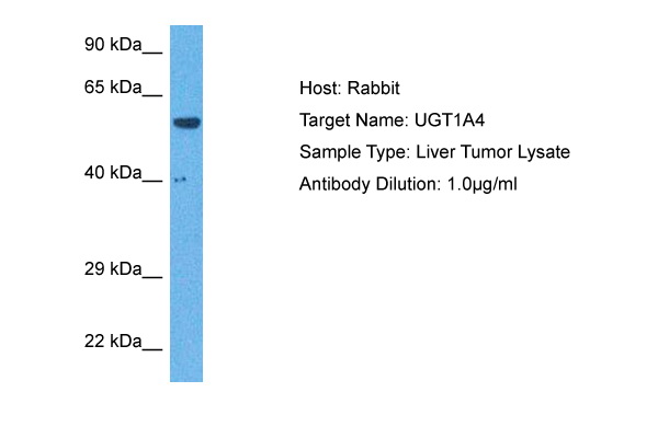 Host: Rabbit Target Name: UGT1A4 Sample Tissue: Human Liver Tumor lysates Antibody Dilution: 1ug/ml