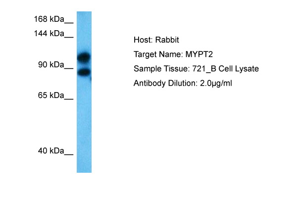 Host: Rabbit Target Name: MYPT2 Sample Type: 721_B Whole Cell Antibody Dilution: 1.0ug/ml