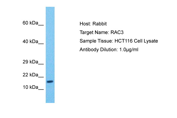 Host: Rabbit Target Name: RAC3 Sample Type: HCT116 Whole Cell Antibody Dilution: 1.0ug/ml