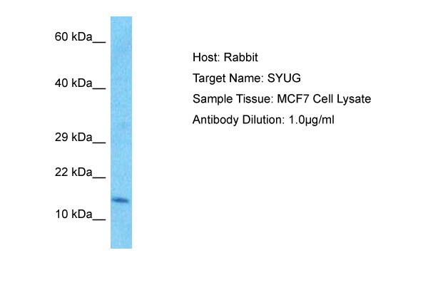 Host: Rabbit Target Name: SYUG Sample Type: MCF7 Whole Cell lysates Antibody Dilution: 1.0ug/ml