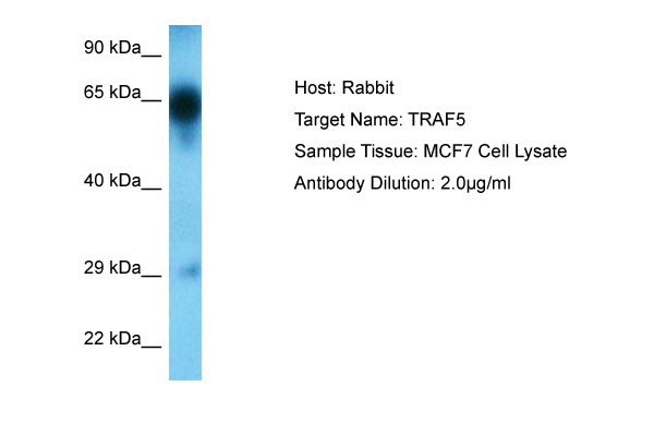 Host: Rabbit Target Name: TRAF5 Sample Type: MCF7 Whole Cell Antibody Dilution: 1.0ug/ml