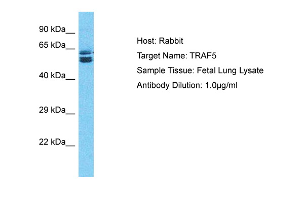 Host: Rabbit Target Name: TRAF5 Sample Type: Fetal Lung lysates Antibody Dilution: 1.0ug/ml