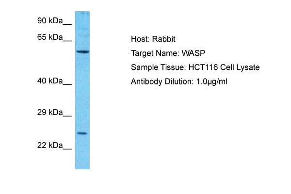 Host: Rabbit Target Name: WASP Sample Type: HCT116 Whole Cell lysates Antibody Dilution: 1.0ug/ml