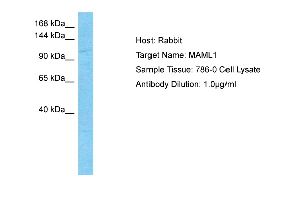 B lymphocytes (CD19+) in a dot-plot Lambda PE vs. Kappa FITC. Kappa light chain detected by A8B5 antibody and lambda light chain by 4C2 antibody, CD19 by LT19 antibody.