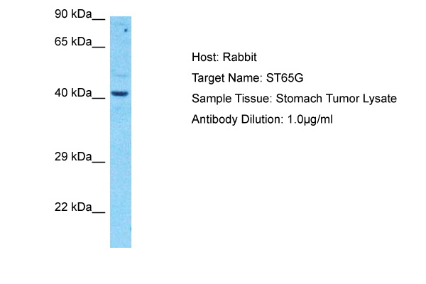 Host: Rabbit Target Name: ST65G Sample Type: Stomach Tumor lysates Antibody Dilution: 1.0ug/ml