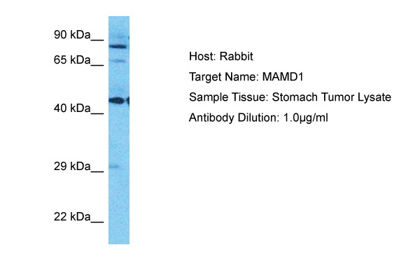 Host: Rabbit Target Name: MAMD1 Sample Type: Stomach Tumor lysates Antibody Dilution: 1.0ug/ml