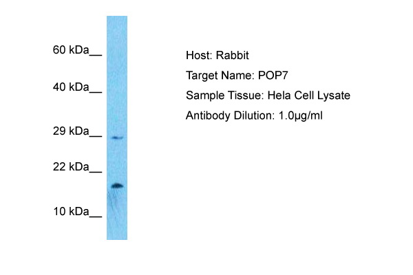 Host: Rabbit Target Name: POP7 Sample Type: Hela Whole Cell lysates Antibody Dilution: 1.0ug/ml