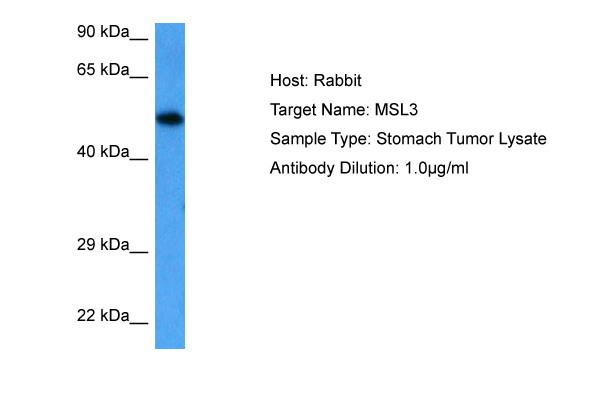 Host: Rabbit Target Name: MSL3 Sample Tissue: Human Stomach Tumor lysates Antibody Dilution: 1ug/ml