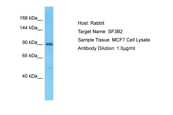 Detection of IgG light chain in reduced samples of Fetal Calf Serum (left lane) and Bovine Serum (right lane) by antibody IVA285-1. This antibody is a suitable tool for in-house quality controls of Fetal Calf Serum (Hybridoma Cell C ulture grade).