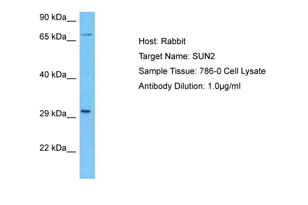 Host: Rabbit Target Name: SUN2 Sample Type: 786-0 Whole Cell lysates Antibody Dilution: 1.0ug/ml