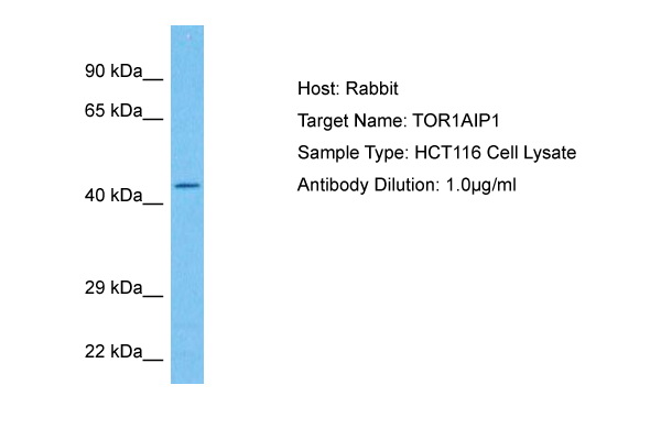 Host: Rabbit Target Name: TOR1AIP1 Sample Tissue: Human HCT116 Whole Cell lysates Antibody Dilution: 1ug/ml