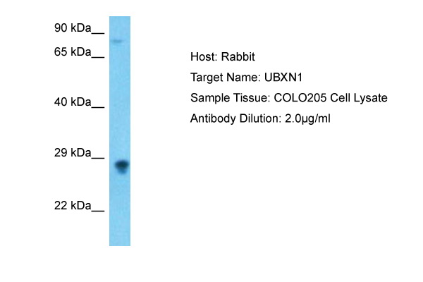 Host: Rabbit Target Name: UBXN1 Sample Type: COLO205 Whole Cell Antibody Dilution: 1.0ug/ml