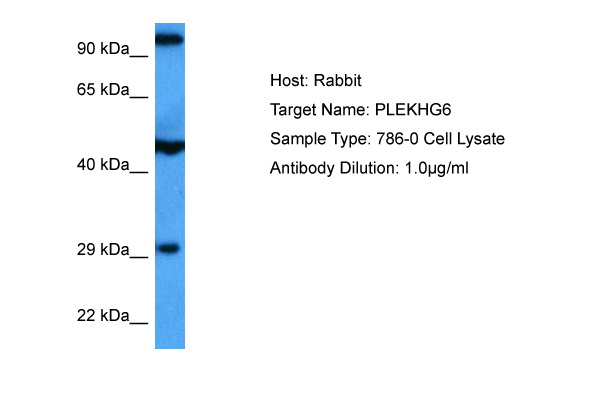 Host: Rabbit Target Name: PLEKHG6 Sample Tissue: Human 786-0 Whole Cell lysates Antibody Dilution: 1ug/ml