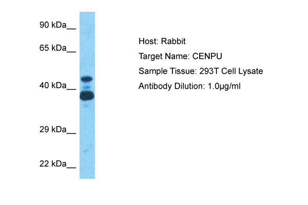 Differential reactivity of monoclonal antibodies to gamma-tub ulin with human gamma-tub ulin isotypes. (A) Immunoblots of total cell lysates from SH-SY5Y cells, expressing TagRFP-tagged human gamma-tub ulin 1 (gamma-Tb1) or gamma-tub ulin 2 (gamma-Tb2), probed with Abs to gamma-tub ulin (TU-30, TU-32), TagRFP (RFP) and GAPDH. In control samples, only secondary anti-mouse Ab was applied. (B) Immunoblots of immobilized GST-tagged human C-terminal regions (a.a. 362-451) of gamma-Tb1 or gamma-Tb2 probed with Abs to gamma-tub ulin (TU-30, TU-32) and GST. In control samples, only secondary anti-mouse Ab was applied.