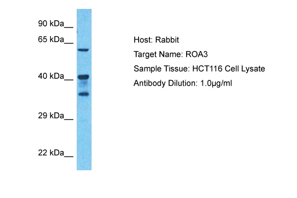 Host: Rabbit Target Name: ROA3 Sample Type: HCT116 Whole Cell lysates Antibody Dilution: 1.0ug/ml