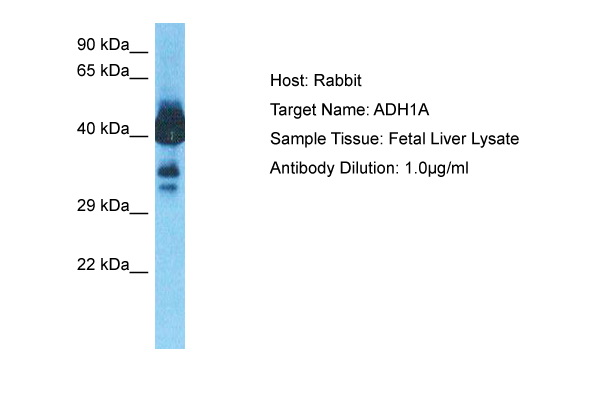 Host: Rabbit Target Name: ADH1A Sample Type: Fetal Liver lysates Antibody Dilution: 1.0ug/ml