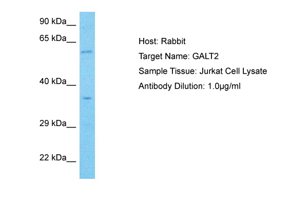 Host: Rabbit Target Name: GALT2 Sample Type: Jurkat Whole Cell lysates Antibody Dilution: 1.0ug/ml