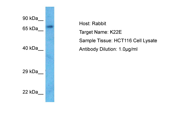 Figure 2. Western blot using ATIC antibody on HT29 cell lysate.
