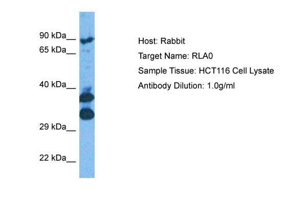 Immunohistochemistry: SELP antibody staining of Formalin-Fixed, Paraffin-Embedded Human Spleen followed by biotinylated secondary antibody, alkaline phosphatase-streptavidin and chromogen.