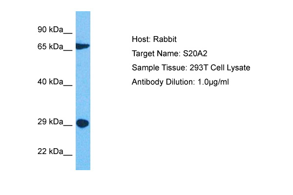 Host: Rabbit Target Name: SLC20A2 Sample Tissue: Human 293T Whole Cell Antibody Dilution: 1.0ug/ml