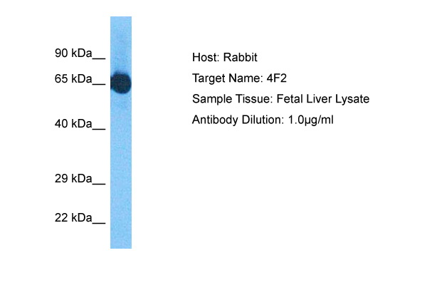 Host: Rabbit Target Name: SLC3A2 Sample Tissue: Human Fetal Liver Antibody Dilution: 1.0ug/ml