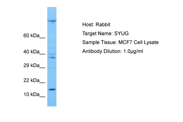 Host: Rabbit Target Name: SNCG Sample Tissue: Human MCF7 Whole Cell Antibody Dilution: 1.0ug/ml