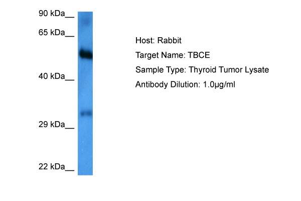 Host: Rabbit Target Name: TBCE Sample Tissue: Thyroid Tumor lysates Antibody Dilution: 1ug/ml