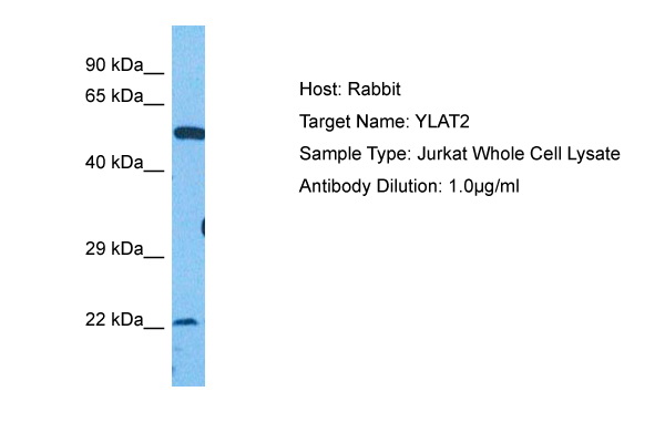 Western Blot analysis: The recombinant Synaptobrevin 1, 2 (each 20ng) and the extracts of Rat brain (20 ug) were resolved by SDS-PAGE, transferred to PVDF membrane and probed with anti-Human Synaptobrevin 2 (1/2,000). Proteins were visualized using a goat anti-Mouse secondary antibody conj ugated to HRP and an ECL detection system. Lane 1: Synaptobrevin 1 Lane 2: Synaptobrevin 2 Lane 3. Rat brain