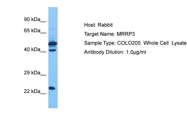 Host: Rabbit Target Name: KIAA0391 Sample Tissue: Human COLO205 Whole Cell Antibody Dilution: 1.0ug/ml