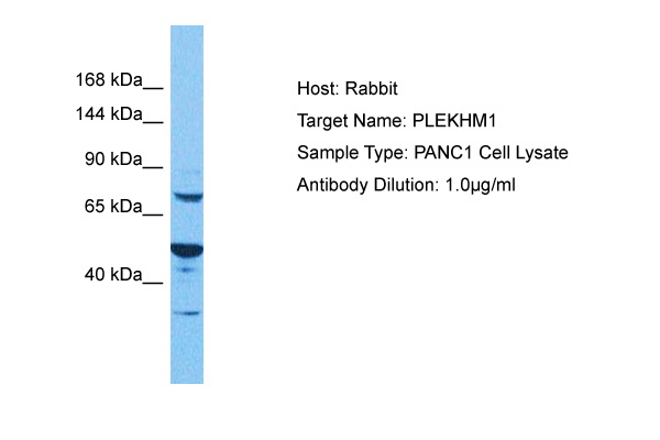 DHEA detected using Dehydroepiandrosterone antibody Cat.-NoAM05657PU-N