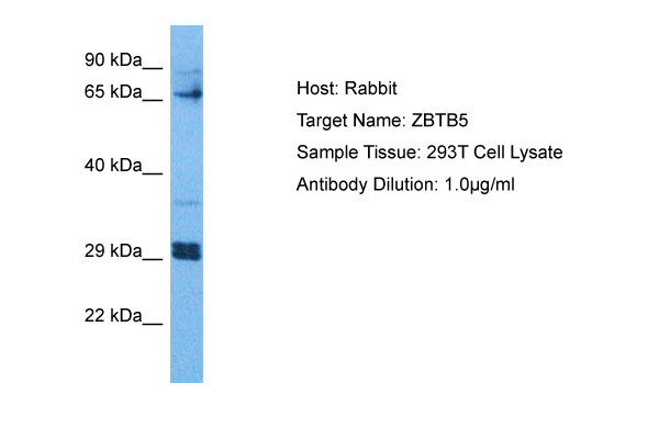 Host: Rabbit Target Name: ZBTB5 Sample Tissue: Human 293T Whole Cell Antibody Dilution: 1.0ug/ml