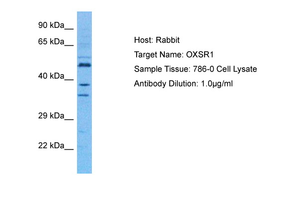 Host: Rabbit Target Name: OXSR1 Sample Tissue: Human 786-0 Whole Cell Antibody Dilution: 1.0ug/ml