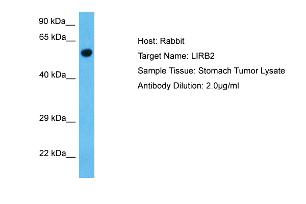 Host: Rabbit Target Name: LILRB2 Sample Tissue: Human Stomach Tumor Antibody Dilution: 1.0ug/ml