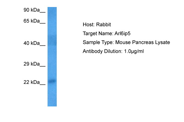 Host: Rabbit Target Name: Arl6ip5 Sample Tissue: Mouse Pancreas lysates Antibody Dilution: 1.0ug/ml