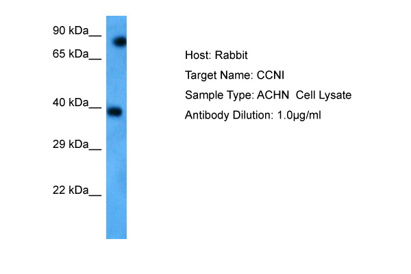 Host: Rabbit Target Name: CCNI Sample Tissue: Human ACHN Whole Cell Antibody Dilution: 1.0ug/ml