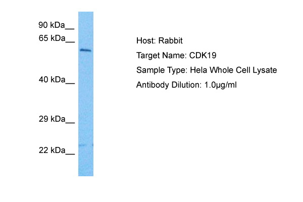 Host: Rabbit Target Name: CDK19 Sample Tissue: Human Hela Whole Cell Antibody Dilution: 1.0ug/ml