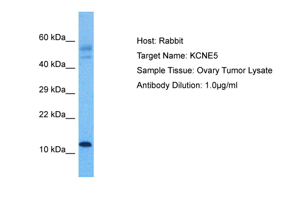 Host: Rabbit Target Name: KCNE1L Sample Tissue: Human Ovary Tumor Antibody Dilution: 1.0ug/ml