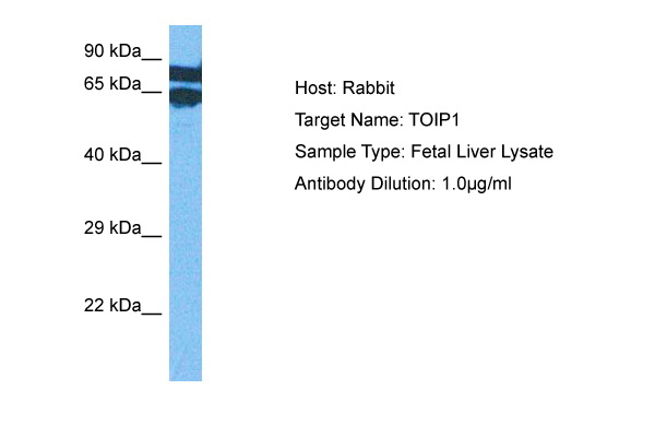 Host: Rabbit Target Name: TOR1AIP1 Sample Tissue: Human Fetal Liver Antibody Dilution: 1.0ug/ml