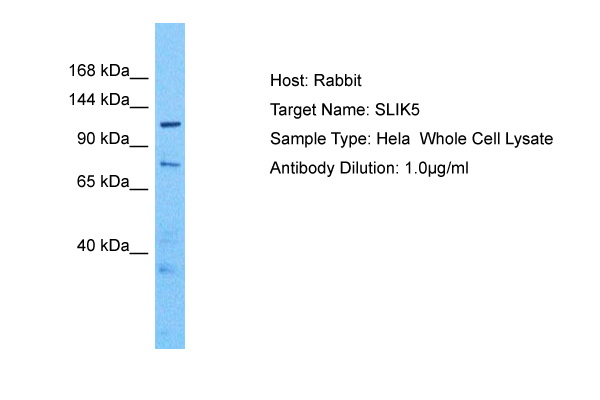 Host: Rabbit Target Name: SLITRK5 Sample Tissue: Human Hela Whole Cell Antibody Dilution: 1.0ug/ml