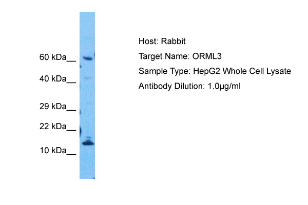 Host: Rabbit Target Name: ORMDL2 Sample Tissue: Human HepG2 Whole Cell Antibody Dilution: 1.0ug/ml